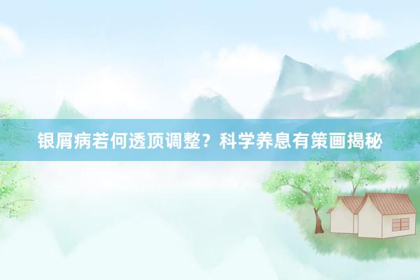 银屑病若何透顶调整？科学养息有策画揭秘